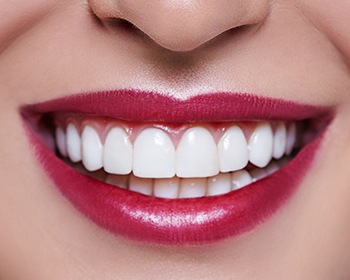 smile with gum recontouring