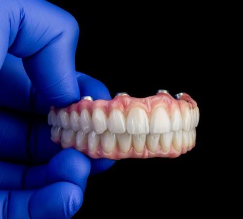 man smiling with implant dentures in Lincoln