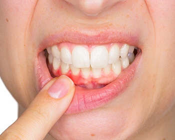 close shot of red gums