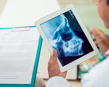 x-ray on tablet with paperwork