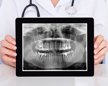 Doctor holding x-ray on tablet