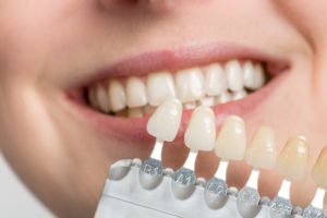 shade guide next to patient’s teeth 